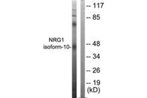 Western blot analysis of extracts from SKOV3 cells, using NRG1 isoform-10 Antibody. (NRG1 Isoform-10 (AA 1-50) Antikörper)