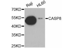 Western blot analysis of extracts of various cell lines, using CASP8 antibody. (Caspase 8 Antikörper)