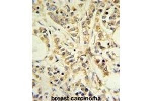 Immunohistochemistry (IHC) image for anti-Ribosomal Protein S13 (RPS13) antibody (ABIN3002137) (RPS13 Antikörper)