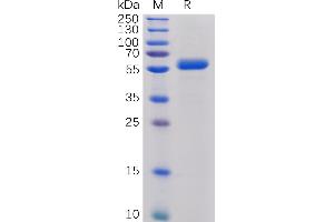 CTLA4 Protein (AA 36-161) (mFc-His Tag)