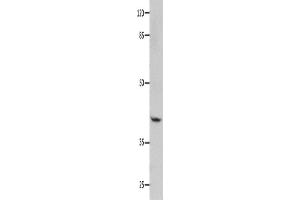 Western Blotting (WB) image for anti-Guanine Nucleotide Binding Protein (G Protein), alpha 11 (Gq Class) (GNA11) antibody (ABIN2428140) (GNA11 Antikörper)