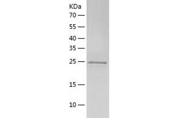 BTF3 Protein (AA 1-206) (His tag)