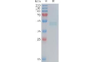 IL11RA Protein (AA 26-367) (His tag)