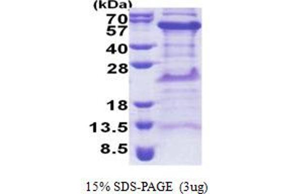 TIPIN Protein (AA 1-301) (His tag)