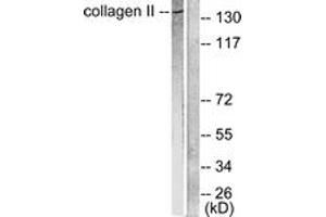 Western blot analysis of extracts from COLO205 cells, using Collagen II Antibody. (COL2 Antikörper  (AA 101-150))