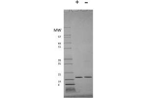 SDS-PAGE of Human Interferon-alpha 2a Recombinant Protein SDS-PAGE of Human Interferon-alpha 2a Recombinant Protein. (IFNA2 Protein)