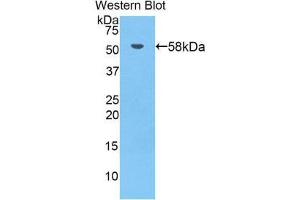 Western Blotting (WB) image for anti-Bruton Agammaglobulinemia tyrosine Kinase (BTK) (AA 396-659) antibody (ABIN1858180) (BTK Antikörper  (AA 396-659))