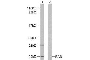 Western blot analysis of extracts from 293 cells using BAD (Ab-136) antibody (E021063). (BAD Antikörper)