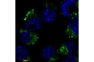 Immunofluorescence (IF) image for anti-Tubulin, beta 3 (TUBB3) (N-Term) antibody (FITC) (ABIN93912)