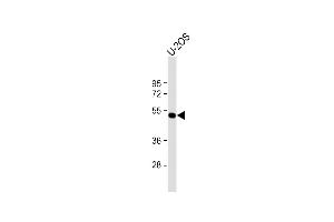 Anti-ANKH Antibody (C-term) at 1:1000 dilution + U-2OS whole cell lysate Lysates/proteins at 20 μg per lane. (ANKH Antikörper  (C-Term))