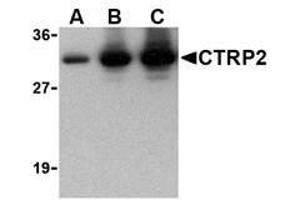 Image no. 1 for anti-C1q and Tumor Necrosis Factor Related Protein 2 (C1QTNF2) antibody (ABIN207843) (C1QTNF2 Antikörper)