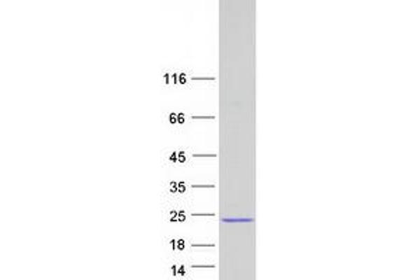 ISCU Protein (Transcript Variant 1) (Myc-DYKDDDDK Tag)