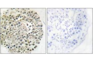 Immunohistochemistry (IHC) image for anti-Tripartite Motif Containing 16 (TRIM16) (AA 31-80) antibody (ABIN2889360) (TRIM16 Antikörper  (AA 31-80))