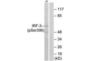 Western blot analysis of extracts from Jurkat cells treated with EGF 200ng/ml 30', using IRF-3 (Phospho-Ser396) Antibody. (IRF3 Antikörper  (pSer396))