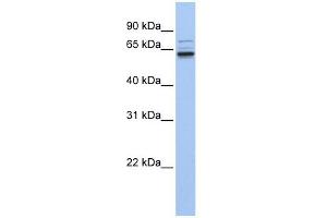 GEFT antibody used at 1 ug/ml to detect target protein. (ARHGEF25/GEFT Antikörper  (C-Term))