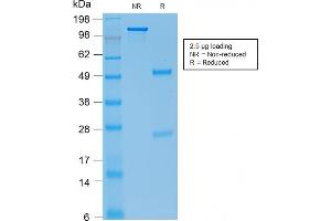 SDS-PAGE (SDS) image for anti-Cadherin 1, Type 1, E-Cadherin (Epithelial) (CDH1) antibody (ABIN6941298)