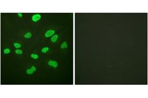 Immunofluorescence analysis of HeLa cells, using Histone H4 (Ab-16) Antibody. (Histone H4 Antikörper  (AA 15-64))