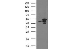 Western Blotting (WB) image for anti-ADP-Ribosylation Factor GTPase Activating Protein 1 (ARFGAP1) antibody (ABIN1496684) (ARFGAP1 Antikörper)