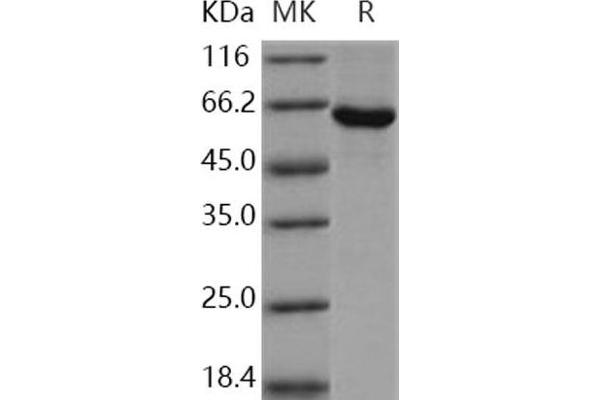 SPHK1 Protein (GST tag,His tag)