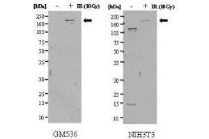 Anti-SMC1 pS957 Antibody - Western Blot. (SMC1B Antikörper  (pSer957))