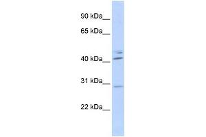 WB Suggested Anti-SPIC Antibody Titration:  0. (SPIC Antikörper  (N-Term))