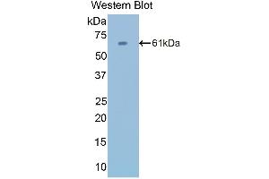 Western Blotting (WB) image for anti-Catalase (CAT) (AA 10-507) antibody (ABIN1858264) (Catalase Antikörper  (AA 10-507))