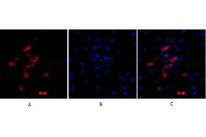 Immunofluorescence analysis of human liver tissue. (p53 Antikörper)