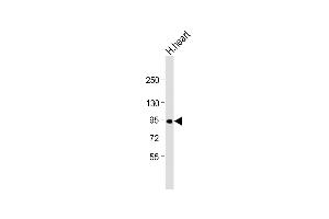 PPP1R3F Antikörper  (C-Term)