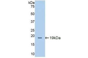 Detection of Recombinant ICAM1, Mouse using Polyclonal Antibody to Intercellular Adhesion Molecule 1 (ICAM1) (ICAM1 Antikörper  (AA 328-465))