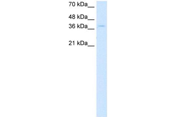 CTDSPL Antikörper  (N-Term)