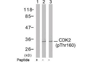 Image no. 2 for anti-Cyclin-Dependent Kinase 2 (CDK2) (pThr160) antibody (ABIN196845) (CDK2 Antikörper  (pThr160))