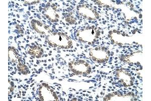 Cytokeratin 18 antibody was used for immunohistochemistry at a concentration of 4-8 ug/ml to stain Alveolar cells (arrows) in Human Lung. (Cytokeratin 18 Antikörper  (C-Term))