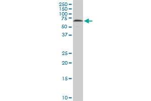 Western Blotting (WB) image for anti-Histone Deacetylase 1 (HDAC1) (AA 1-482) antibody (ABIN516392)