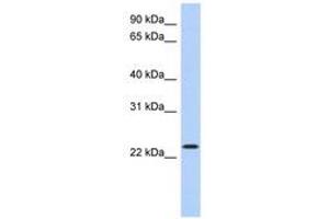 Image no. 1 for anti-Activating Transcription Factor 3 (ATF3) (AA 71-120) antibody (ABIN6740496) (ATF3 Antikörper  (AA 71-120))