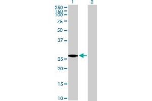 Western Blot analysis of IGL@ expression in transfected 293T cell line by IGL@ MaxPab polyclonal antibody. (IgL Antikörper  (AA 1-232))