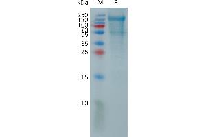 PCDH18 Protein (AA 28-697) (His tag)