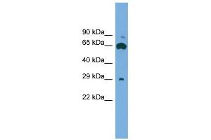 GLIPR1L1 antibody used at 1 ug/ml to detect target protein. (GLIPR1L1 Antikörper  (Middle Region))