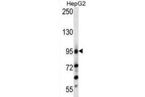 Western Blotting (WB) image for anti-Leucine-Rich Repeat Containing G Protein-Coupled Receptor 5 (LGR5) (Loop 2) antibody (ABIN2937468) (LGR5 Antikörper  (Loop 2))