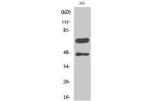 Western Blotting (WB) image for anti-Caspase 8 (CASP8) (Asp384), (cleaved) antibody (ABIN3181767) (Caspase 8 Antikörper  (Asp384, cleaved))