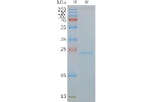 Human C-Nanodisc, Flag Tag on SDS-PAGE (CMTM6 Protein)