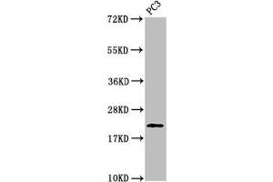 Western Blot Positive WB detected in: PC-3 whole cell lysate All lanes: HIST1H1D antibody at 1 μg/mL Secondary Goat polyclonal to rabbit IgG at 1/50000 dilution Predicted band size: 23 kDa Observed band size: 23 kDa (Histone H1.3 Antikörper  (pThr146))