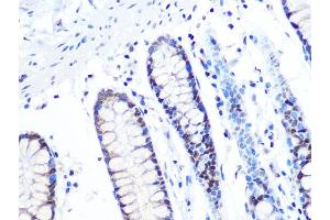 Immunohistochemistry of paraffin-embedded human colon using MT Rabbit mAb (ABIN1679683, ABIN7101713, ABIN7101714 and ABIN7101715) at dilution of 1:100 (40x lens). (MTA2 Antikörper)