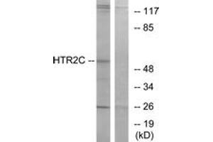 Western blot analysis of extracts from Jurkat cells, using HTR2C Antibody. (HTR2C Antikörper  (AA 395-444))