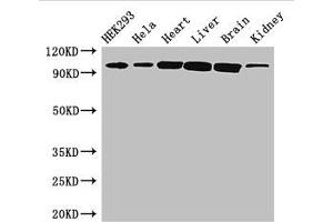 Western Blot Positive WB detected in: HEK293 whole cell lysate, Hela whole cell lysate, Mouse heart tissue, Mouse liver tissue, Mouse brain tissue, Mouse kidney tissue All lanes: CDH2 antibody at 3 μg/mL Secondary Goat polyclonal to rabbit IgG at 1/50000 dilution Predicted band size: 100, 98 kDa Observed band size: 100 kDa (N-Cadherin Antikörper  (AA 746-906))