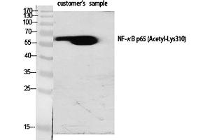 Western Blot analysis of various cells using Acetyl-NFκB-p65 (K310) Polyclonal Antibody diluted at 1:1000. (NF-kB p65 Antikörper  (acLys310))