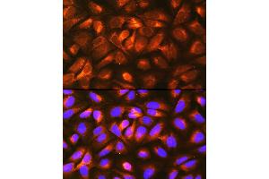 Immunofluorescence analysis of U-2 OS cells using LRP Rabbit pAb  at dilution of 1:100 (40x lens). (LRPAP1 Antikörper  (AA 35-357))
