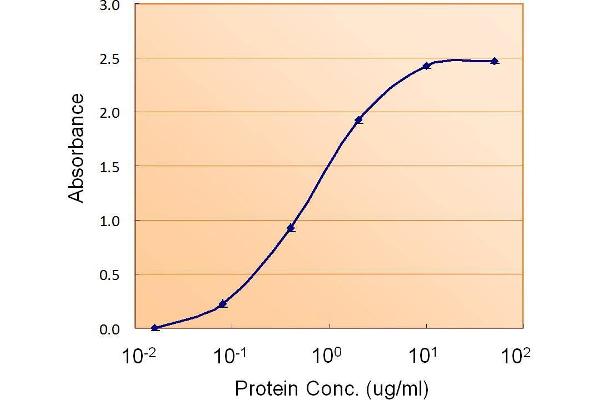 Acetyl-CoA Carboxylase beta Antikörper  (Internal Region)