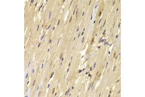 Immunohistochemistry of paraffin-embedded mouse heart using TOPBP1 antibody (ABIN5973403) at dilution of 1/100 (40x lens). (TOPBP1 Antikörper)