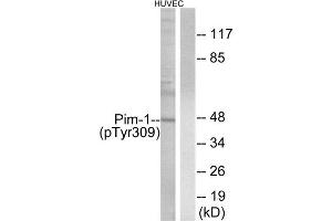 Western Blotting (WB) image for anti-Pim-1 Oncogene (PIM1) (pTyr309) antibody (ABIN1847325) (PIM1 Antikörper  (pTyr309))