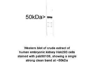 Image no. 1 for anti-Vimentin (VIM) antibody (ABIN363417) (Vimentin Antikörper)